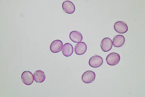 Lichtmikroskopische Aufnahme von mit Fuchsin gefärbten Pollen der Edelkastanie (Foto: Landesagentur für Umwelt und Klimaschutz)