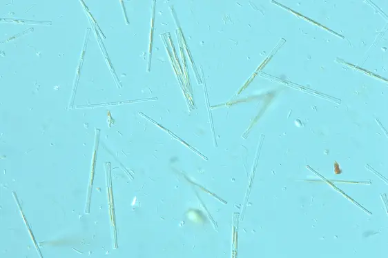 Aufnahme Lichtmikroskop: pelagische Kieselalgen, 400 fache Vergrößerung (Foto: Landesagentur für Umwelt und Klimaschutz)