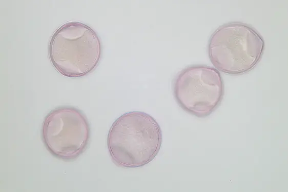 Lichtmikroskopische Aufnahme von mit Fuchsin gefärbten Pollen der Hasel (Foto: Landesagentur für Umwelt und Klimaschutz)