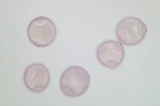 Lichtmikroskopische Aufnahme von mit Fuchsin gefärbten Pollen der Hasel (Foto: Landesagentur für Umwelt und Klimaschutz)