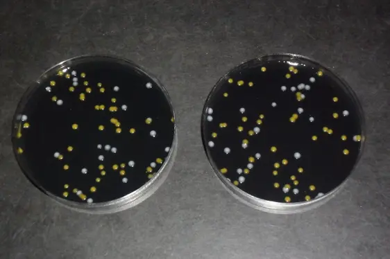Mikrobiologische Untersuchung: Nachweis von Legionella; Petrischalen mit Legionella-Kolonien (Foto: Landesagentur für Umwelt und Klimaschutz)