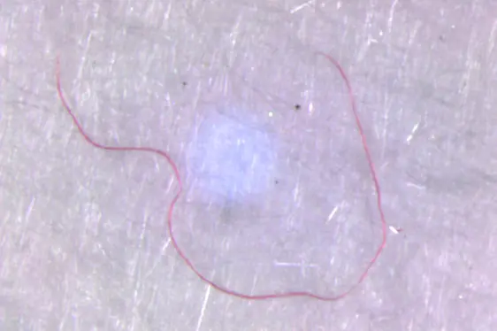 Monitoraggio microplastica - progetto pilota