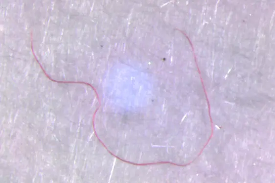 Erhebung Mikroplastik - Pilotprojekt