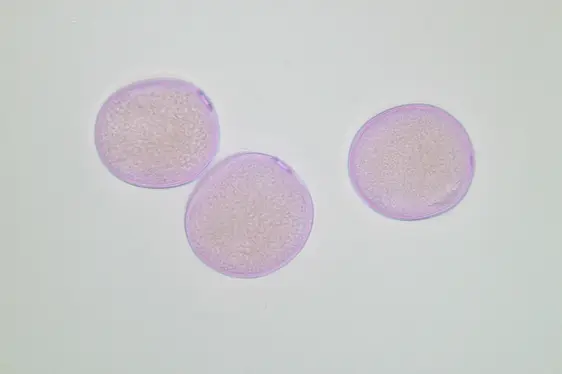 Lichtmikroskopische Aufnahme von mit Fuchsin gefärbten Pollen des Knäuelgrases (Foto: Landesagentur für Umwelt und Klimaschutz)