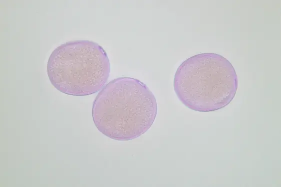 Lichtmikroskopische Aufnahme von mit Fuchsin gefärbten Pollen des Knäuelgrases (Foto: Landesagentur für Umwelt und Klimaschutz)