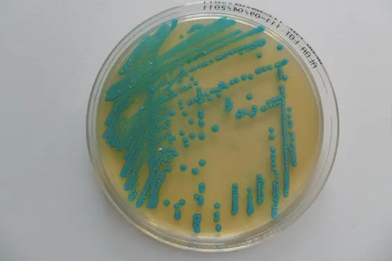 Mikrobiologische Untersuchung: Listeria in Lebensmitteln; Petrischale mit Listeria monocytogenes-Kolonien (Foto: Landesagentur für Umwelt und Klimaschutz)