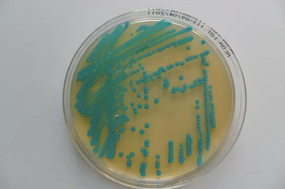 Mikrobiologische Untersuchung: Listeria in Lebensmitteln; Petrischale mit Listeria monocytogenes-Kolonien (Foto: Landesagentur für Umwelt und Klimaschutz)