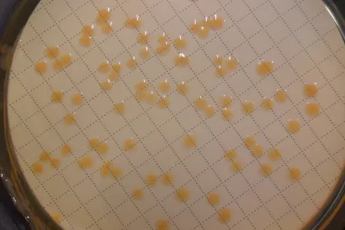 Piastra di Petri con colonie batteriche cresciute su terreno di coltura idoneo (Foto: Agenzia provinciale per l’ambiente e la tutela del clima)