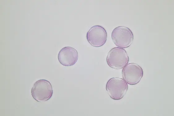 Lichtmikroskopische Aufnahme von mit Fuchsin gefärbten Pollen der Weide (Foto: Landesagentur für Umwelt und Klimaschutz)