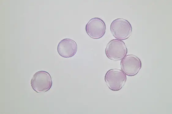 Lichtmikroskopische Aufnahme von mit Fuchsin gefärbten Pollen der Weide (Foto: Landesagentur für Umwelt und Klimaschutz)