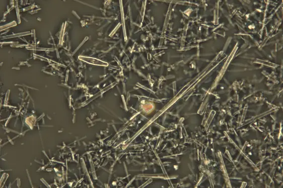 Aufnahme Lichtmikroskop: Kieselalgenschalen, von den weißen Steinen abgebürstet, 1000 fache Vergrößerung (Foto: Landesagentur für Umwelt und Klimaschutz)