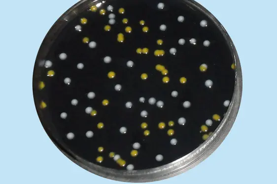 Kolonien von Legionella spp. (weiße Kolonien) auf Selektivnährboden (Foto: Landesagentur für Umwelt und Klimaschutz)