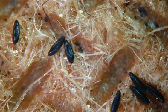 L’ingrandimento allo stereomicroscopio facilita la distinzione delle uova lunghe circa mezzo millimetro da eventuali particelle di sporcizia (Foto: Agenzia provinciale per l'ambiente e la tutela del clima)