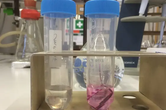 Analyse von Nikellässigkeit in Modeschmuck (Foto: Landesagentur für Umwelt und Klimaschutz)