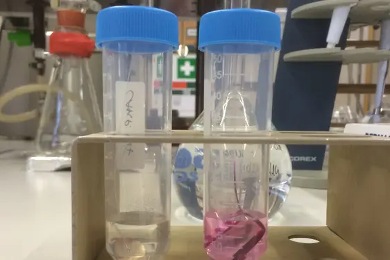 Analyse von Nikellässigkeit in Modeschmuck (Foto: Landesagentur für Umwelt und Klimaschutz)