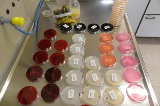 Nach erfolgter Bebrütung: selektive Nährböden mit Bakterienkulturen (Foto: Landesagentur für Umwelt und Klimaschutz)