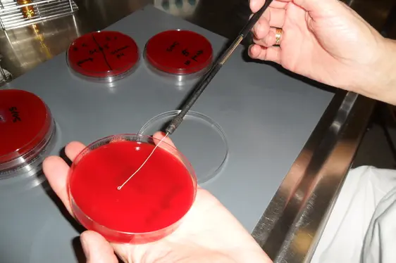 Ausstrich einer verdünnten Probe auf den Nährboden (Foto: Landesagentur für Umwelt und Klimaschutz)