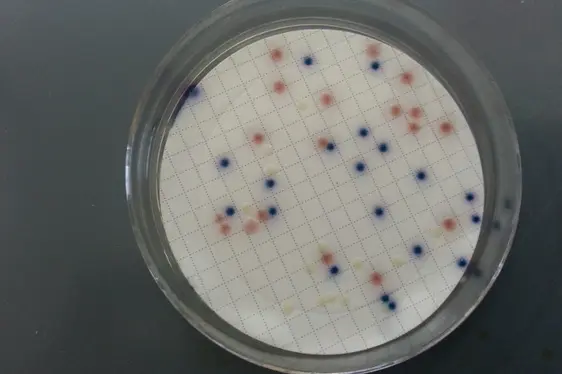 Osservazione e conteggio delle unità formanti colonie (ufc) cresciute dopo incubazione delle piastre (Foto: Agenzia provinciale per l’ambiente e la tutela del clima)