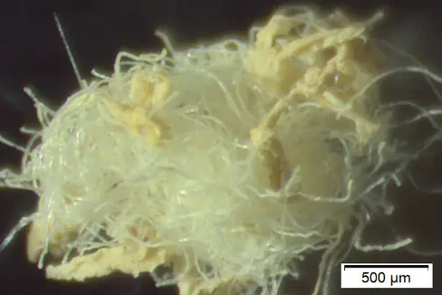 Mikroplastik unter dem Mikroskop (Foto: Landesagentur für Umwelt und Klimaschutz)