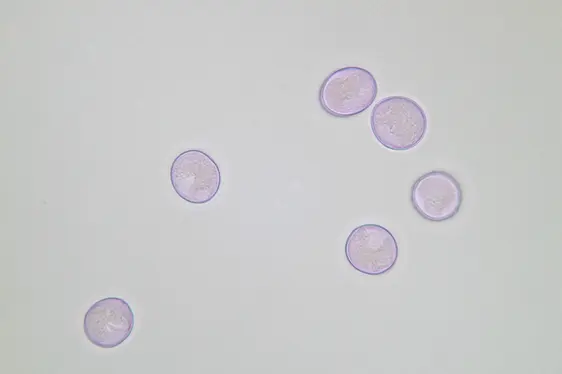 Lichtmikroskopische Aufnahme von mit Fuchsin gefärbten Brennnessel-Pollen (Foto: Landesagentur für Umwelt und Klimaschutz)