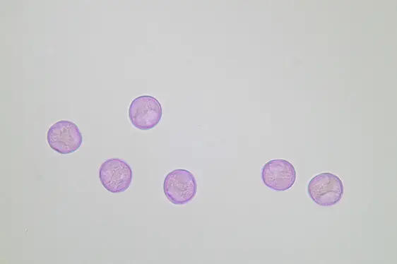 Lichtmikroskopische Aufnahme von mit Fuchsin gefärbten Glaskraut-Pollen (Foto: Landesagentur für Umwelt und Klimaschutz)