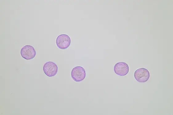 Lichtmikroskopische Aufnahme von mit Fuchsin gefärbten Glaskraut-Pollen (Foto: Landesagentur für Umwelt und Klimaschutz)