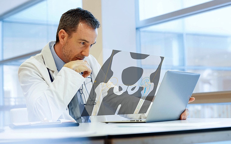 A doctor looking at a laptop with a screen showing a pelvic bone with measurements projected upwards.