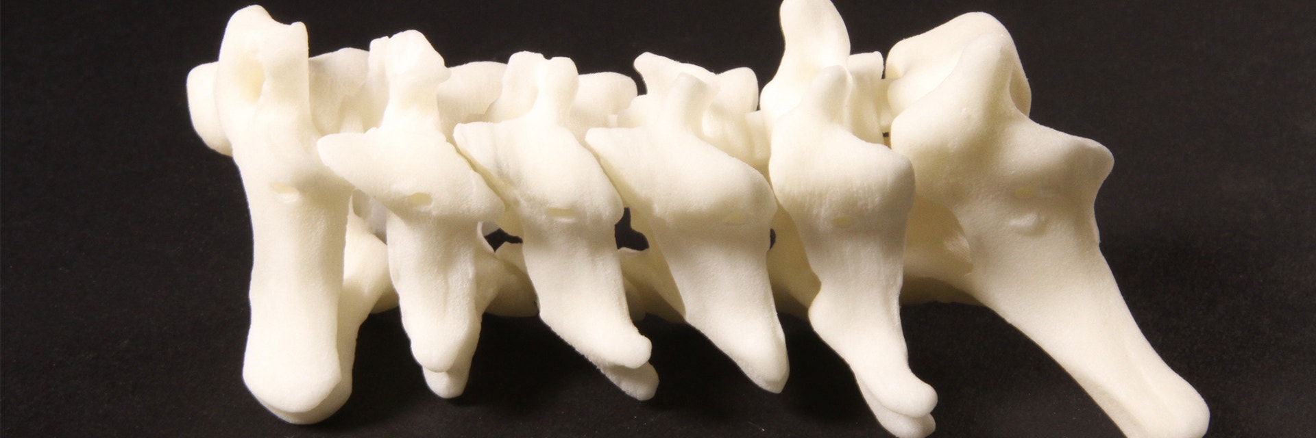 3D Printed spine