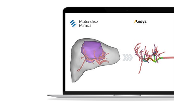 Segmentation and simulation shown in one workflow from the liver on the left and the injection on the right shown on a laptop screen.