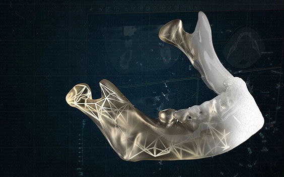 Digital render of a jaw in 3D
