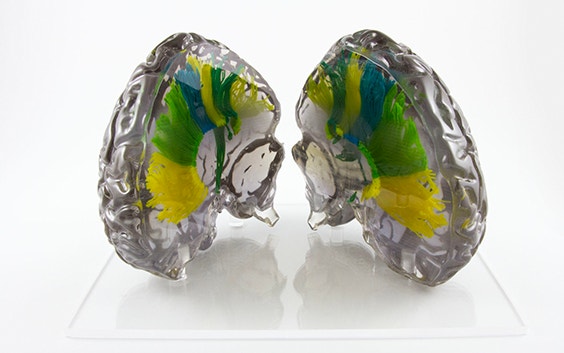 3D-printed anatomical model of human brain 