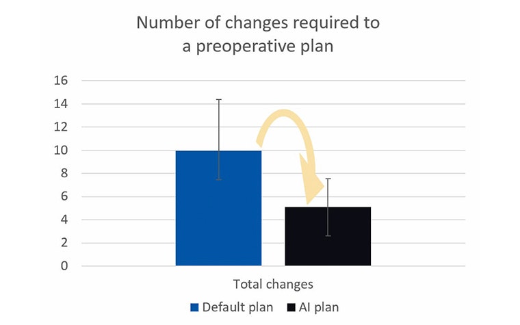 Graph showing the decrease in changes with AI plans 