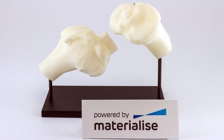 Two 3D-printed surgical knee guides on a stand that says "powered by Materialise"