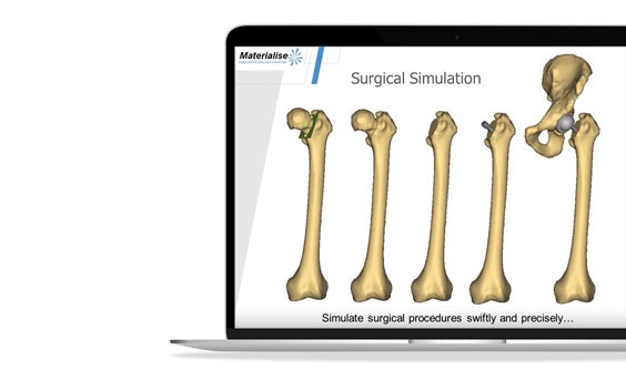 ssm-ssd-simulation-surgical-procedures.jpg