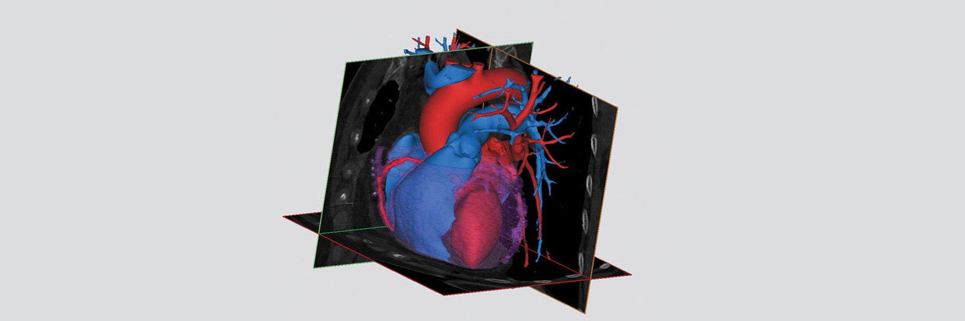 3D digital model of a heart in software