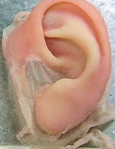 The 3D-printed prosthetic ear before attachment.