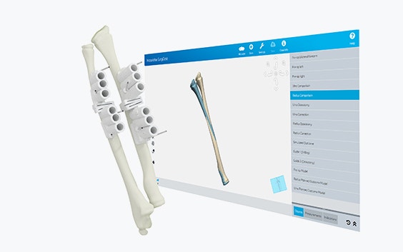 hm-planning-guides-osteotomy-render.jpg