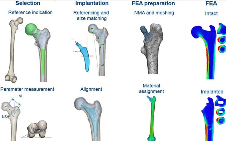 Digital images of bones with various tools applied in medical planning software