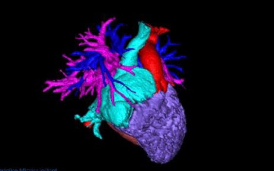 Digital image of a heart with various sections in different colors