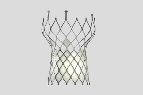 Digital image of heart valve