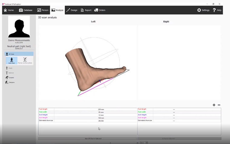 View of a 3D scan analysis on a foot within the footscan software