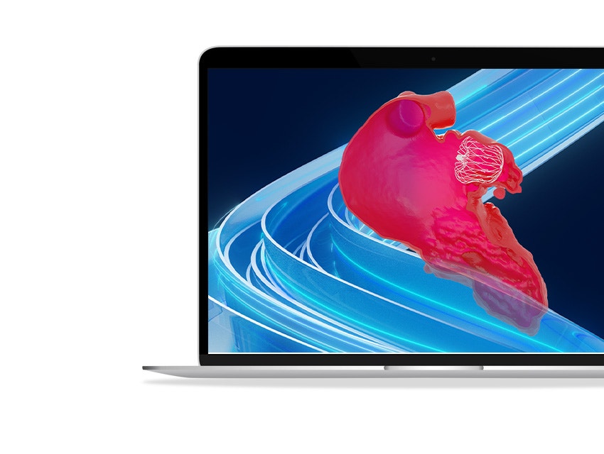ssd-cardiovascular-solutions-mimics-laao-left-atrial-appendage-occlusion.jpg