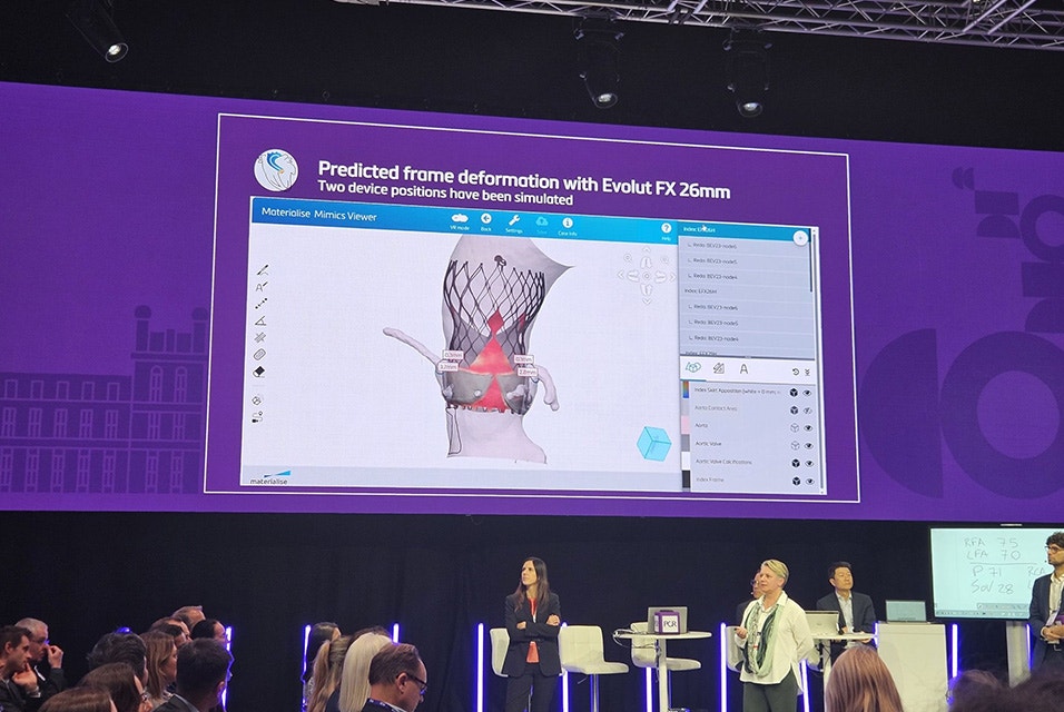 A group of people, including Dr. Wykrzykowska, standing on stage at PCR London Valves 2025 in front of a live audience, with a presentation on the screen behind her. The screen shows text saying "Predicted frame deformation with Evolut FX 22 mm."