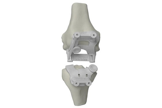 3D-printed knee guide shown on digital bones 