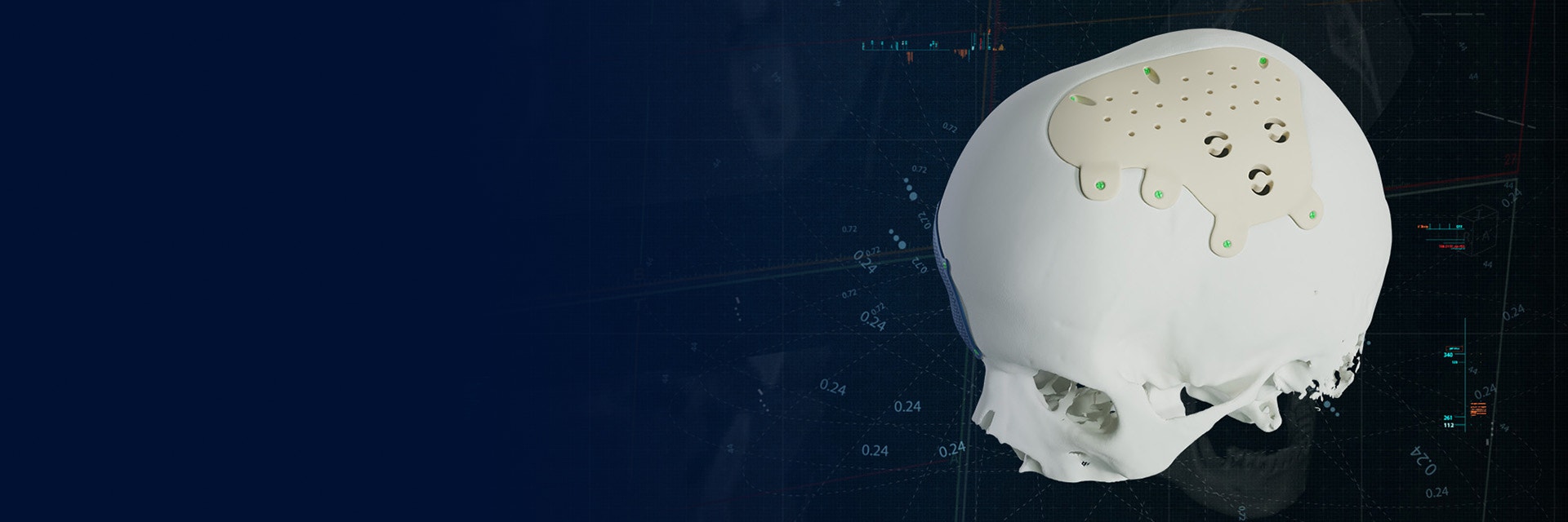 A white skull with a Materialise CMF PEEK implant on a blue background.