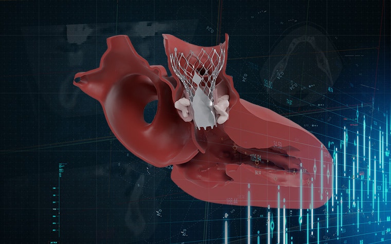 Digital render of a valve within a heart