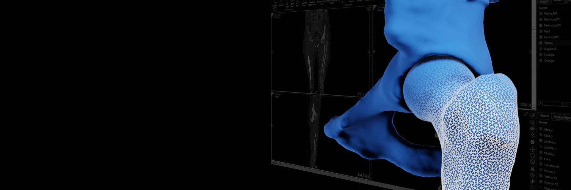 Digitales Bild eines Knochens mit Markierungen auf dem unteren Vorderteil