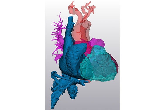 Colorful digital image of a heart