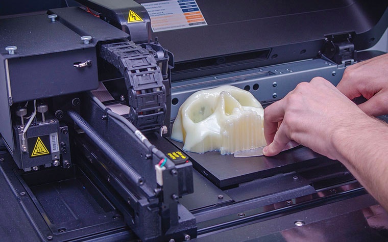 Person removing a 3D-printed model of a patient's skull from a 3D printer