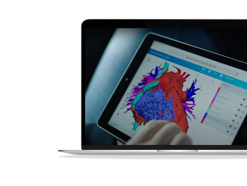 ssd-ipad-surgicase-3d-model-heart.jpg